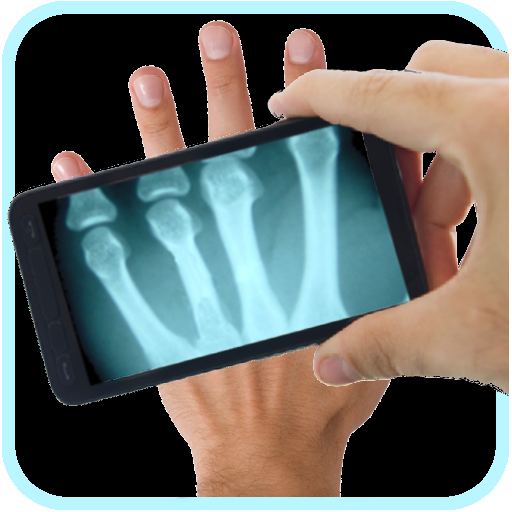 Xray Scanner:Amazon.Co.Uk:Appstore For Android