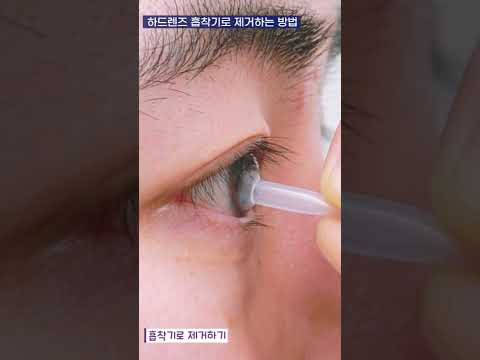 하드렌즈 빼는법