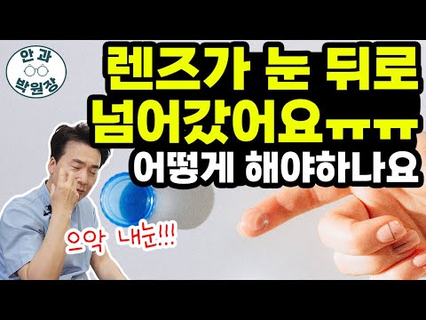 렌즈가 눈 뒤로 넘어갔어요. 어떻게 해야 하나요?