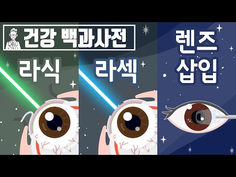 라식 vs 라섹 vs 렌즈삽입술