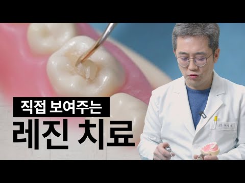 모형으로 레진 치료 전과정 보여드릴게요