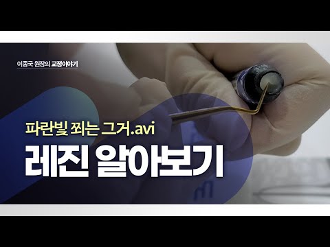 충치치료 종류 - 레진치료 (resin filling) 에 대해 알아보겠습니다. 주의사항 과 함께