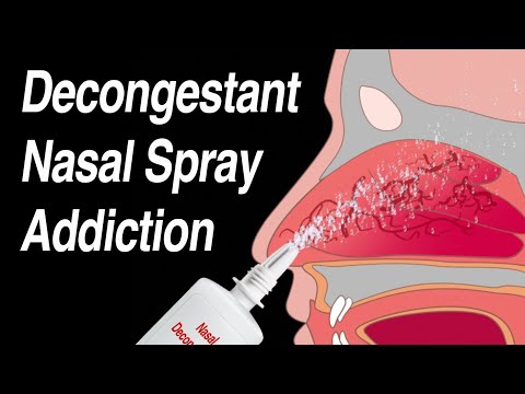 Decongestant Nasal Spray Addiction (Afrin, Zicam, Sinex, Neo-Synephrine, etc)