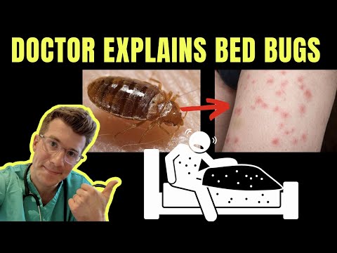 Doctor explains BED BUGS - including SYMPTOMS, TREATMENT AND PREVENTION ( +PHOTOS!)