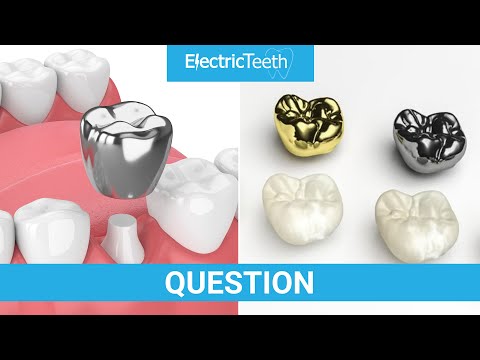 How long do dental crowns last?