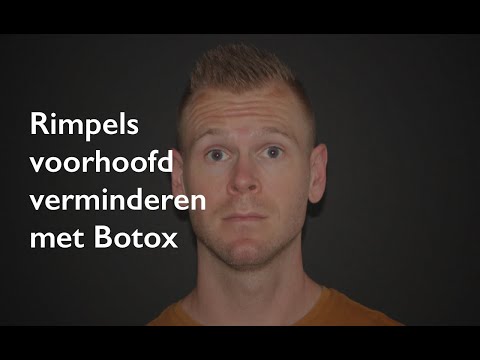 Rimpels voorhoofd: voorhoofdrimpels verwijderen met Botox