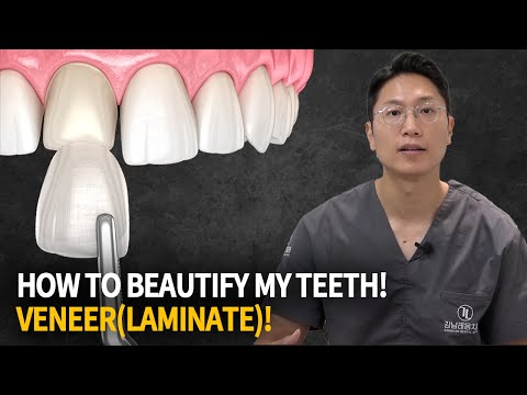 Make your teeth more beautiful! | Everything about the Veneer!