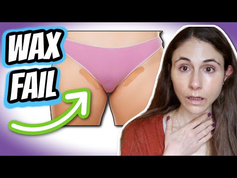 How to prevent HAIR WAXING FAILS | bumps, breakouts, redness, ingrown hairs, burns| Dr Dray