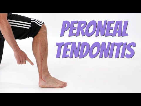 Peroneal Tendonitis (Side of Foot Pain), Causes & Self-Treatment.