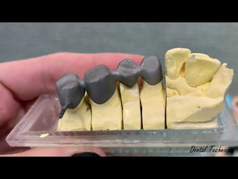 Dental bridge framework - try in procedure